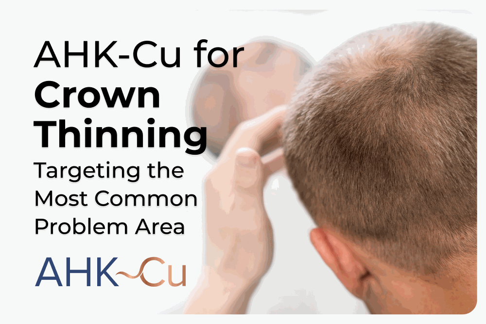 hairloss ahk cu reddit AHK-Cu for Crown Thinning Use once in the What Are Weight Loss Size:2oz Glass Dropper Bottle vitamin B1 B6 B12 injection