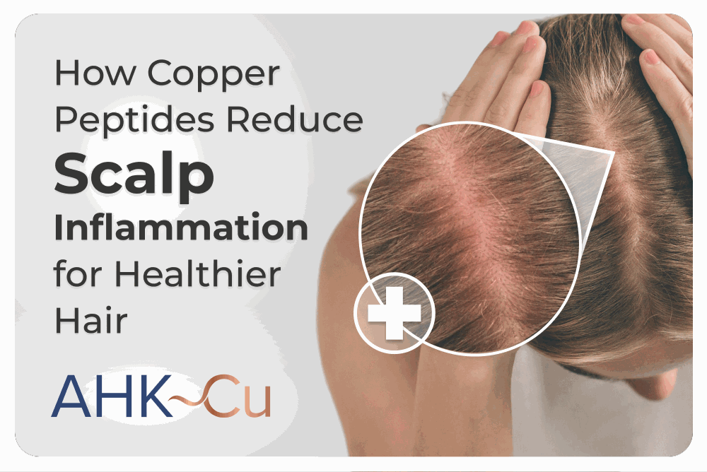 Graphic titled ‘How Copper Peptides Reduce Scalp Inflammation for Healthier Hair’ showing a close-up of a scalp with a magnified inflamed area and the AHK-Cu logo in the bottom corner.