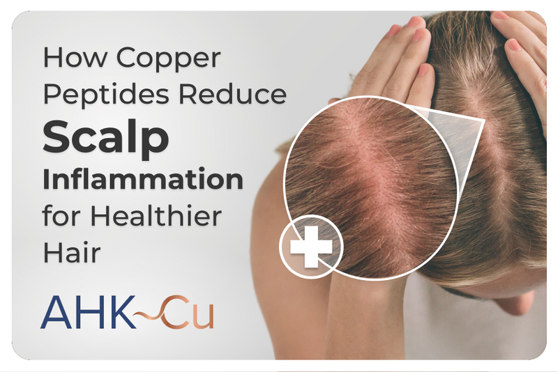 Graphic titled ‘How Copper Peptides Reduce Scalp Inflammation for Healthier Hair’ showing a close-up of a scalp with a magnified inflamed area and the AHK-Cu logo in the bottom corner.