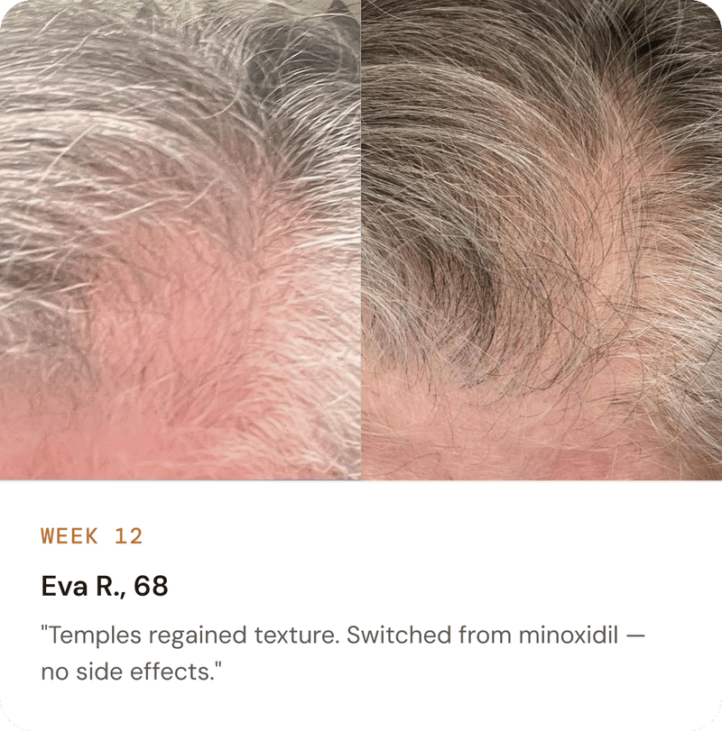 AHK-Cu before and after: part line width at week 0 and week 12, verified customer photo